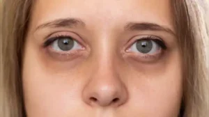 about your liver health 